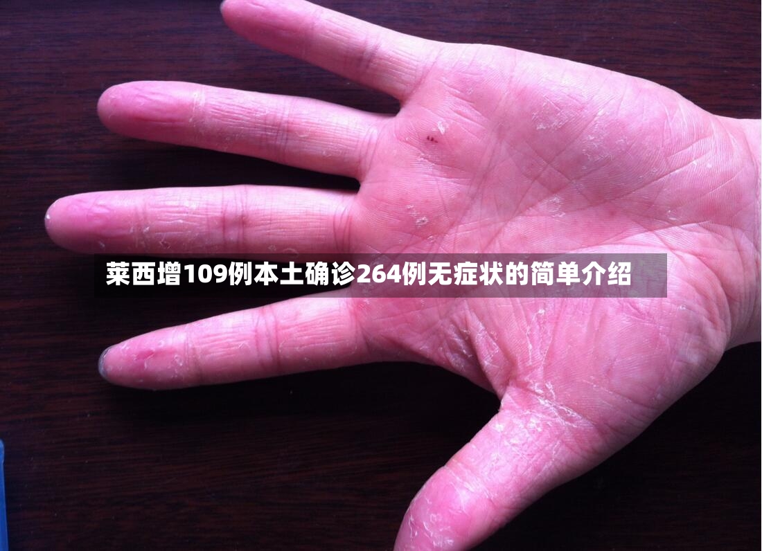 莱西增109例本土确诊264例无症状的简单介绍-第2张图片