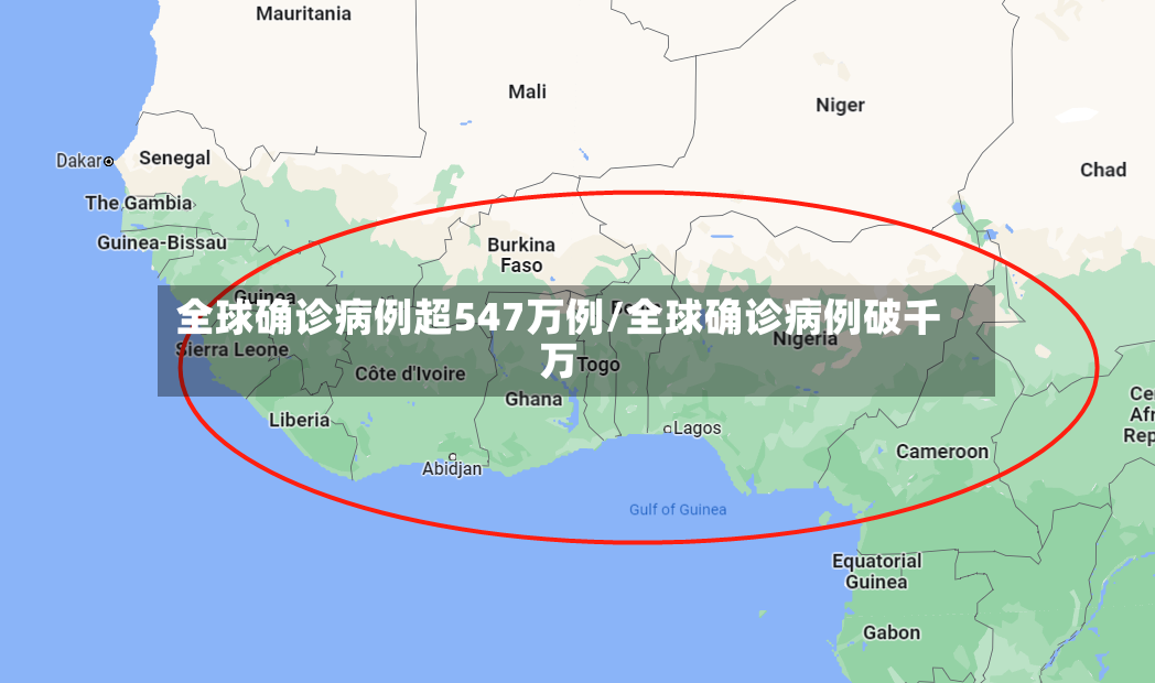 全球确诊病例超547万例/全球确诊病例破千万