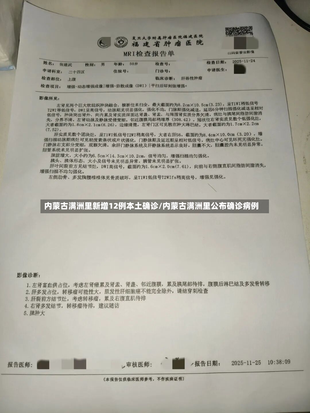 内蒙古满洲里新增12例本土确诊/内蒙古满洲里公布确诊病例-第2张图片