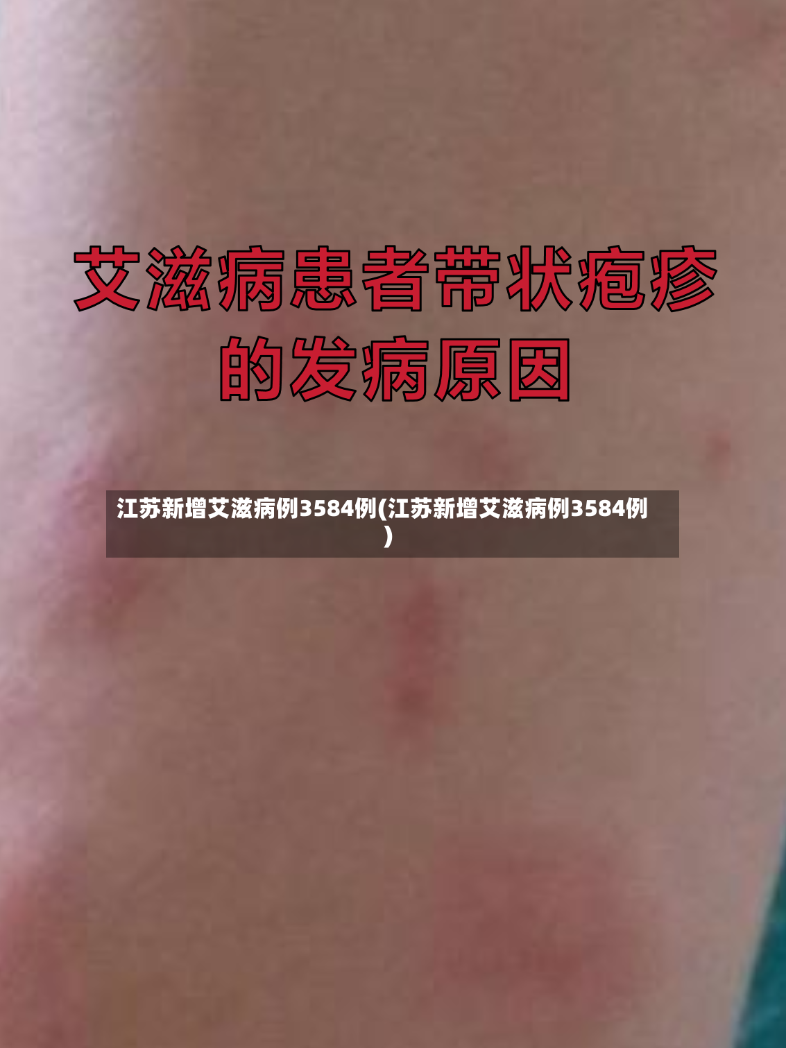 江苏新增艾滋病例3584例(江苏新增艾滋病例3584例)-第2张图片
