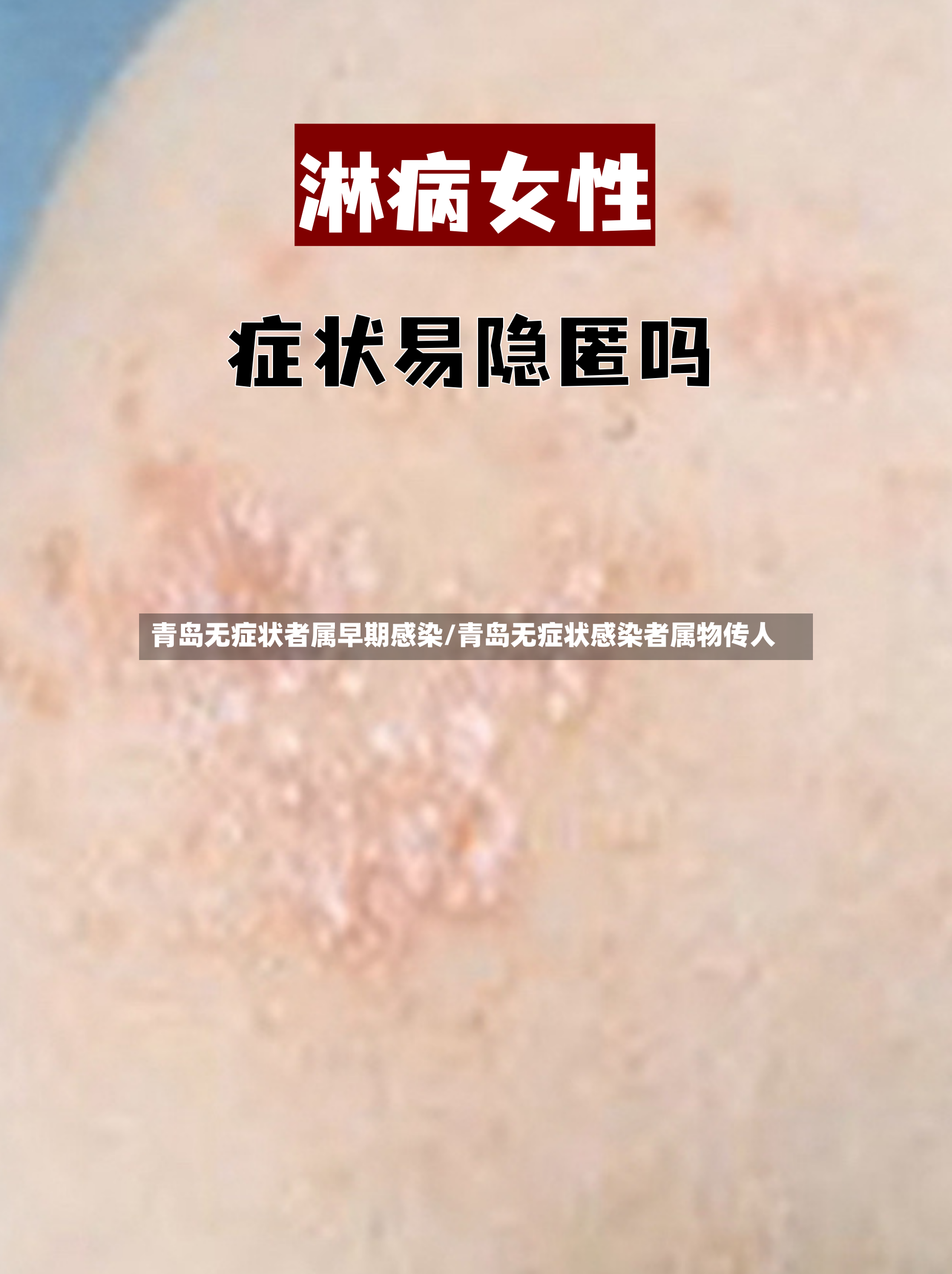青岛无症状者属早期感染/青岛无症状感染者属物传人