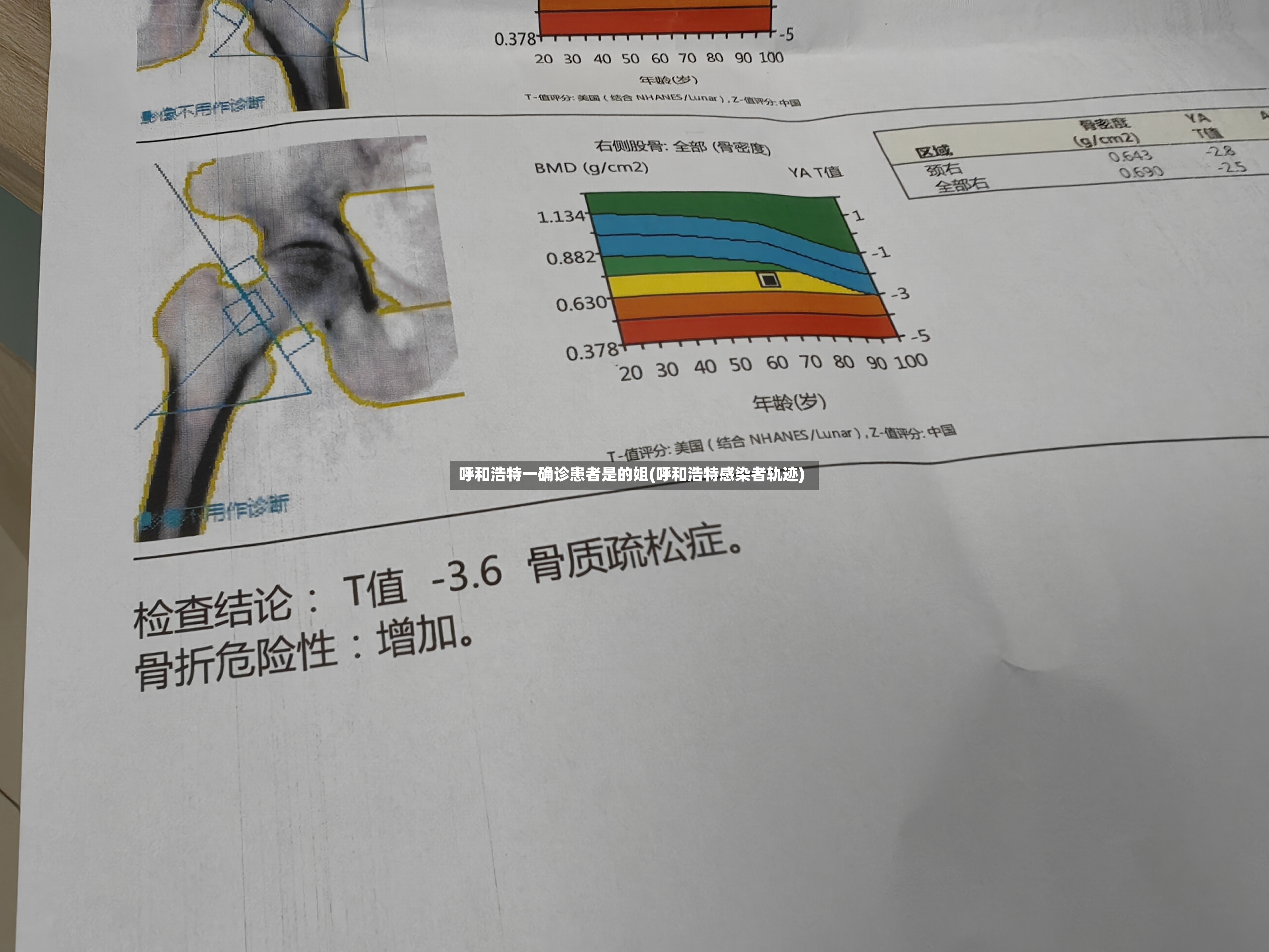 呼和浩特一确诊患者是的姐(呼和浩特感染者轨迹)-第2张图片