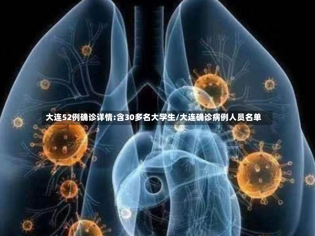 大连52例确诊详情:含30多名大学生/大连确诊病例人员名单-第2张图片