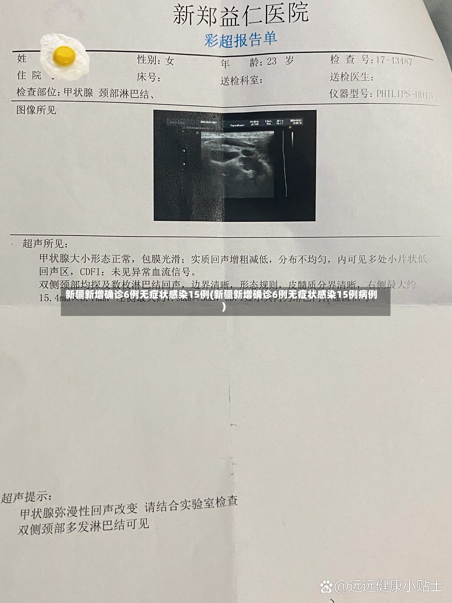 新疆新增确诊6例无症状感染15例(新疆新增确诊6例无症状感染15例病例)-第3张图片