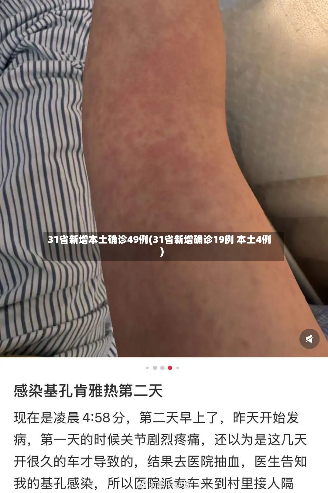 31省新增本土确诊49例(31省新增确诊19例 本土4例)-第3张图片